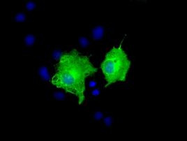 AK5 Antibody in Immunocytochemistry (ICC/IF)