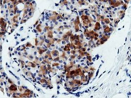 AK5 Antibody in Immunohistochemistry (Paraffin) (IHC (P))