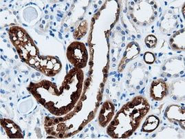 AK5 Antibody in Immunohistochemistry (Paraffin) (IHC (P))