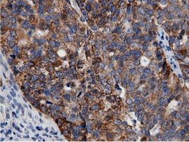 AK5 Antibody in Immunohistochemistry (Paraffin) (IHC (P))