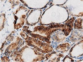 AK5 Antibody in Immunohistochemistry (Paraffin) (IHC (P))