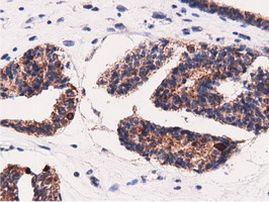 AK5 Antibody in Immunohistochemistry (Paraffin) (IHC (P))