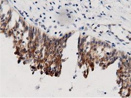 AK5 Antibody in Immunohistochemistry (Paraffin) (IHC (P))