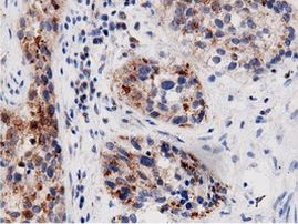 AK5 Antibody in Immunohistochemistry (Paraffin) (IHC (P))