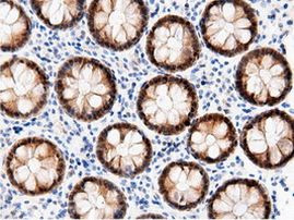 AK5 Antibody in Immunohistochemistry (Paraffin) (IHC (P))