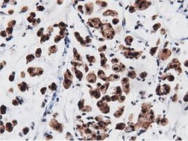 AK5 Antibody in Immunohistochemistry (Paraffin) (IHC (P))