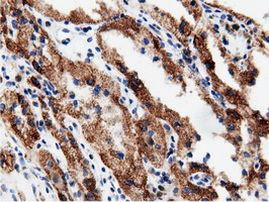 AK5 Antibody in Immunohistochemistry (Paraffin) (IHC (P))