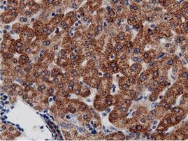 AK5 Antibody in Immunohistochemistry (Paraffin) (IHC (P))