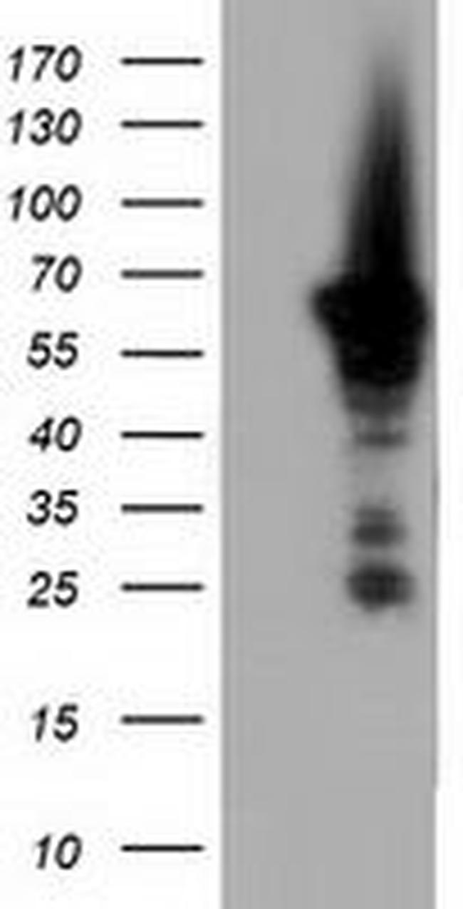 AK5 Antibody in Western Blot (WB)