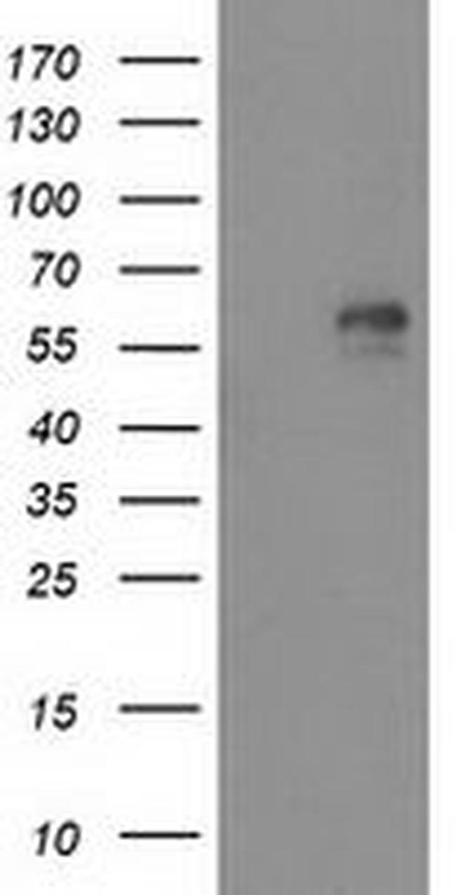 AK5 Antibody in Western Blot (WB)