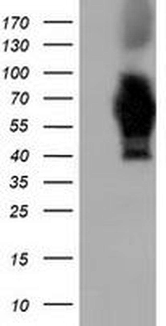 AK5 Antibody in Western Blot (WB)