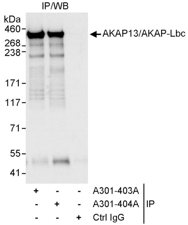 AKAP13/AKAP-Lbc Antibody in Immunoprecipitation (IP)