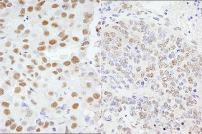 AKAP8/AKAP95 Antibody in Immunohistochemistry (IHC)