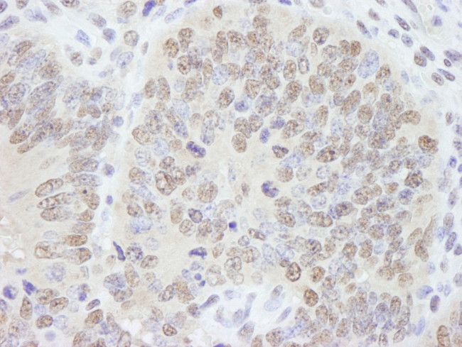 AKAP8/AKAP95 Antibody in Immunohistochemistry (IHC)