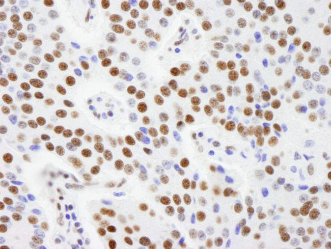 AKAP8L/HA95 Antibody in Immunohistochemistry (IHC)