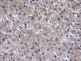 AKR1A1 Antibody in Immunohistochemistry (Paraffin) (IHC (P))