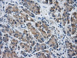 AKR1A1 Antibody in Immunohistochemistry (Paraffin) (IHC (P))