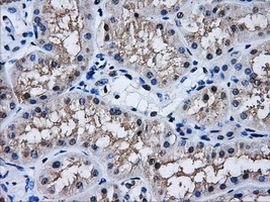 AKR1A1 Antibody in Immunohistochemistry (Paraffin) (IHC (P))