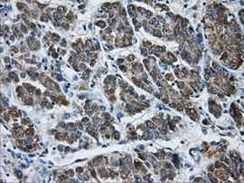 AKR1A1 Antibody in Immunohistochemistry (Paraffin) (IHC (P))