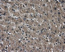 AKR1A1 Antibody in Immunohistochemistry (Paraffin) (IHC (P))