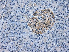 AKR1A1 Antibody in Immunohistochemistry (Paraffin) (IHC (P))