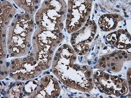 AKR1A1 Antibody in Immunohistochemistry (Paraffin) (IHC (P))