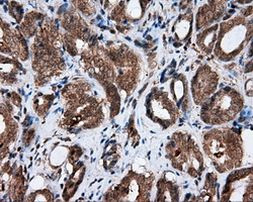 AKR1A1 Antibody in Immunohistochemistry (Paraffin) (IHC (P))