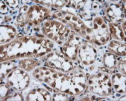 AKR1A1 Antibody in Immunohistochemistry (Paraffin) (IHC (P))