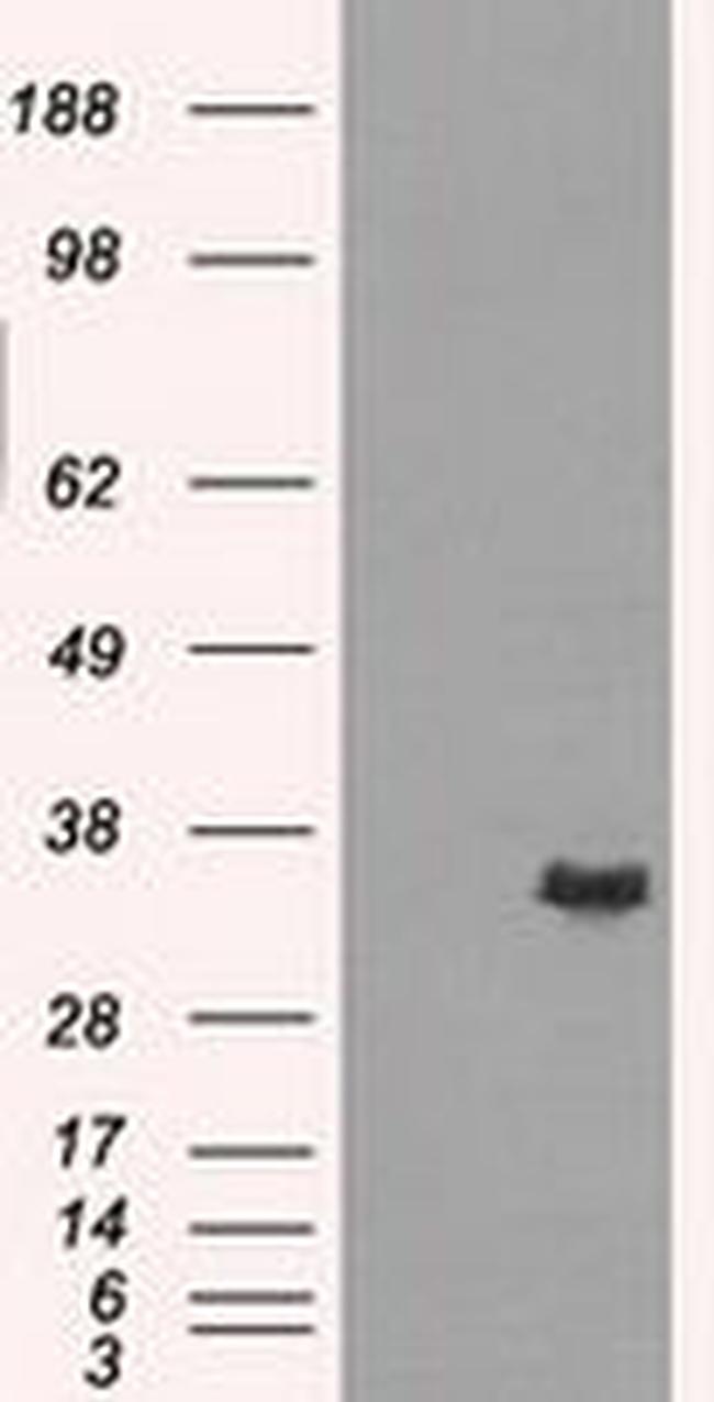 AKR1A1 Antibody in Western Blot (WB)