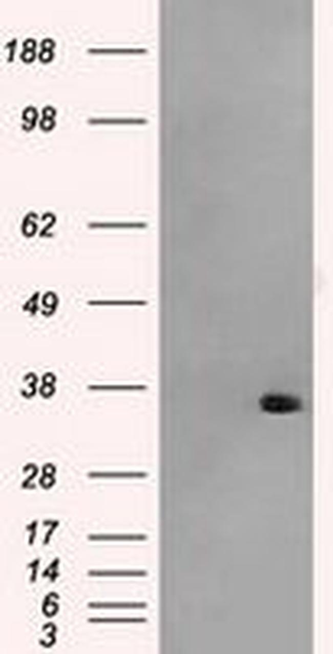 AKR1A1 Antibody in Western Blot (WB)