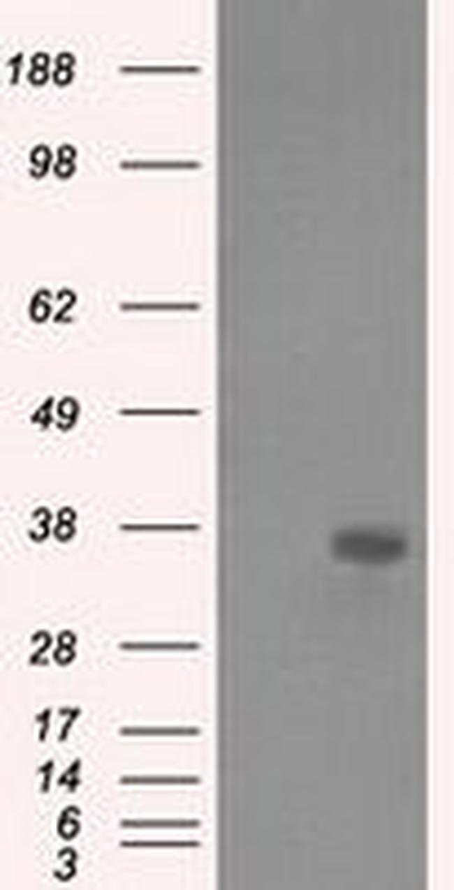 AKR1A1 Antibody in Western Blot (WB)