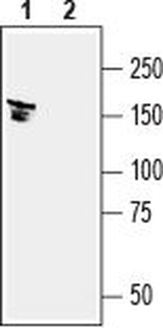 KCC2 (SLC12A5) Antibody in Western Blot (WB)