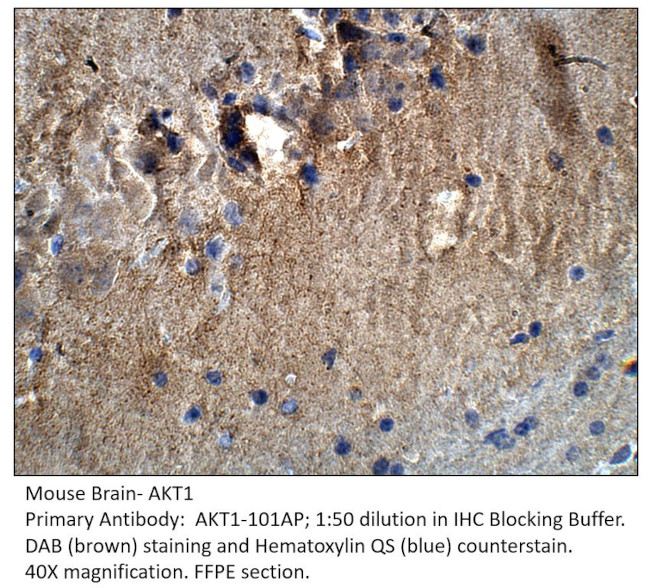 AKT1 Antibody in Immunohistochemistry (IHC)