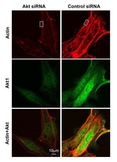 AKT1 Antibody in Immunocytochemistry (ICC/IF)