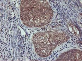 AKT1 Antibody in Immunohistochemistry (Paraffin) (IHC (P))