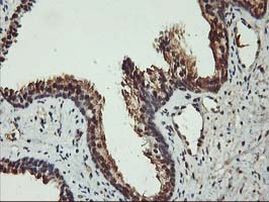 AKT1 Antibody in Immunohistochemistry (Paraffin) (IHC (P))