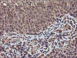 AKT1 Antibody in Immunohistochemistry (Paraffin) (IHC (P))