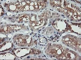 AKT1 Antibody in Immunohistochemistry (Paraffin) (IHC (P))