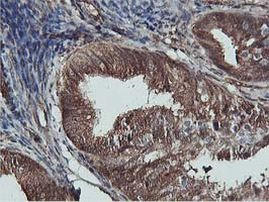 AKT1 Antibody in Immunohistochemistry (Paraffin) (IHC (P))