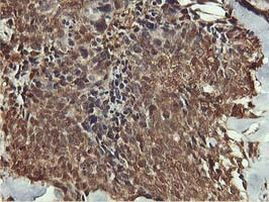 AKT1 Antibody in Immunohistochemistry (Paraffin) (IHC (P))