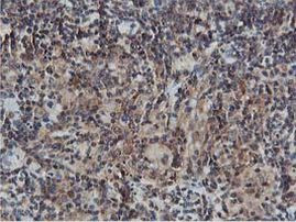 AKT1 Antibody in Immunohistochemistry (Paraffin) (IHC (P))