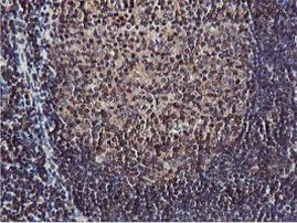 AKT1 Antibody in Immunohistochemistry (Paraffin) (IHC (P))