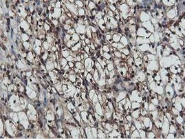 AKT1 Antibody in Immunohistochemistry (Paraffin) (IHC (P))