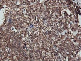 AKT1 Antibody in Immunohistochemistry (Paraffin) (IHC (P))