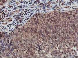 AKT1 Antibody in Immunohistochemistry (Paraffin) (IHC (P))