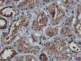 AKT1 Antibody in Immunohistochemistry (Paraffin) (IHC (P))