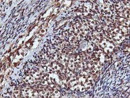 AKT1 Antibody in Immunohistochemistry (Paraffin) (IHC (P))