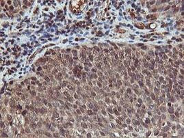 AKT1 Antibody in Immunohistochemistry (Paraffin) (IHC (P))