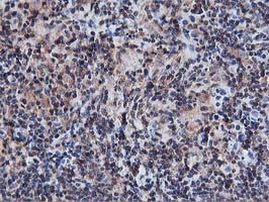 AKT1 Antibody in Immunohistochemistry (Paraffin) (IHC (P))