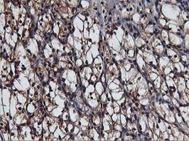 AKT1 Antibody in Immunohistochemistry (Paraffin) (IHC (P))